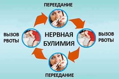 Лечение булимии в Конаково